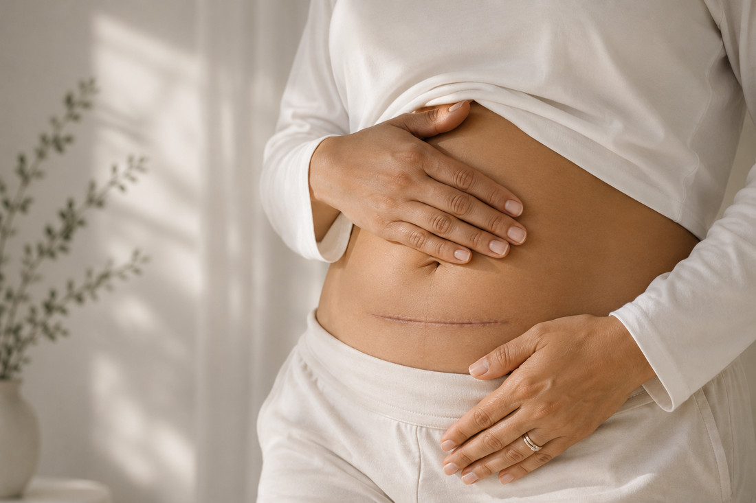 Can You Belly Bind After a C-Section? What to Know